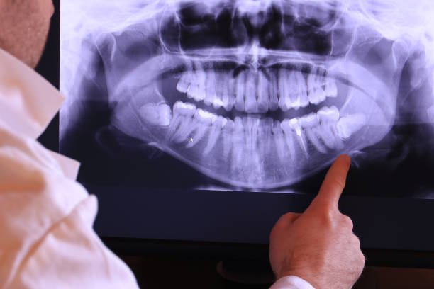 Best Chipped Tooth Repair Near Me  in Medicine Lodge, KS